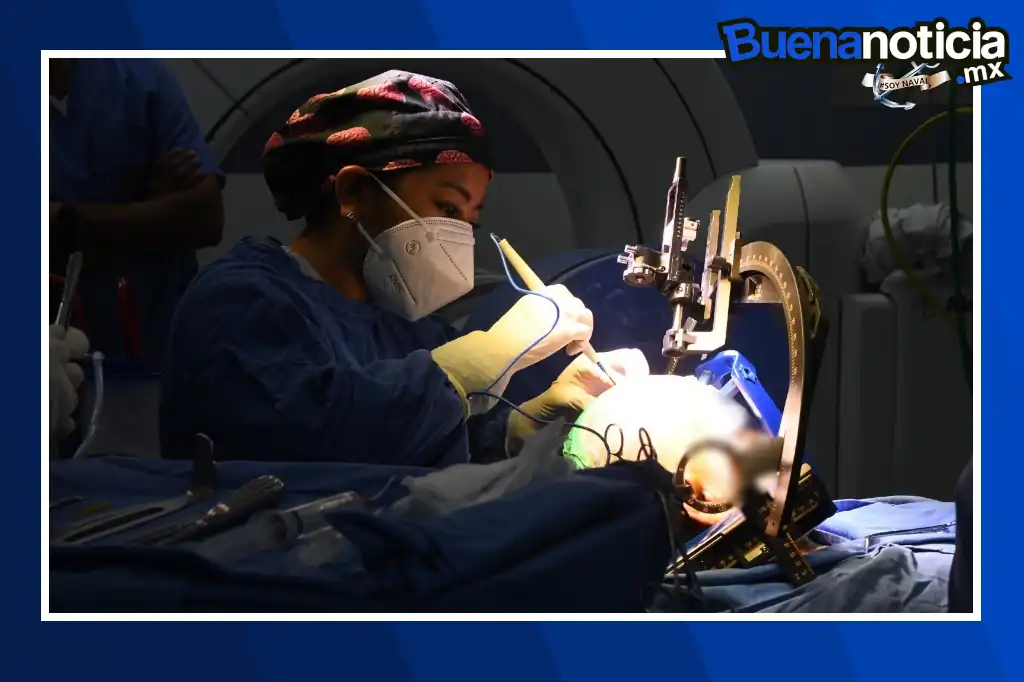 El Centro Médico Naval de México reportó el éxito de dos cirugías pioneras para tratar el Parkinson, utilizando por primera vez en el país el sistema de estereotaxia Leksell Vantage, un equipo de alta precisión, informó la Secretaría de Marina-Armada de México (Semar).