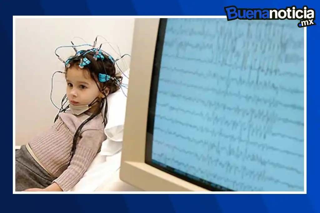 Una innovadora herramienta de inteligencia artificial desarrollada en Australia promete transformar el diagnóstico y tratamiento de la epilepsia infantil al identificar pequeñas malformaciones cerebrales que suelen pasar desapercibidas en las resonancias magnéticas tradicionales.