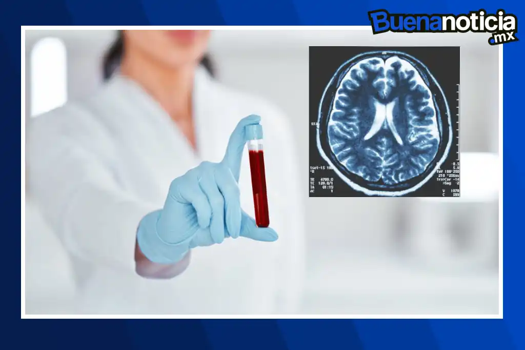 Buena noticia: Nuevo análisis de sangre promete detectar tumores cerebrales con alta precisión