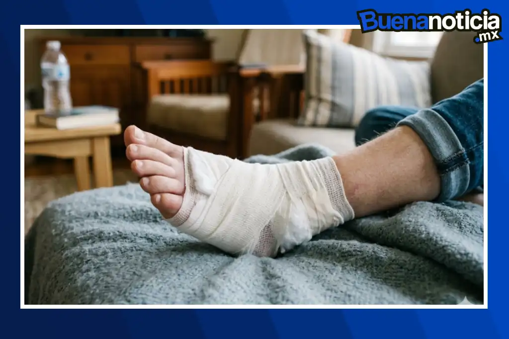 Buena noticia: IPN desarrolla parche dérmico para acelerar la cicatrización del pie diabético